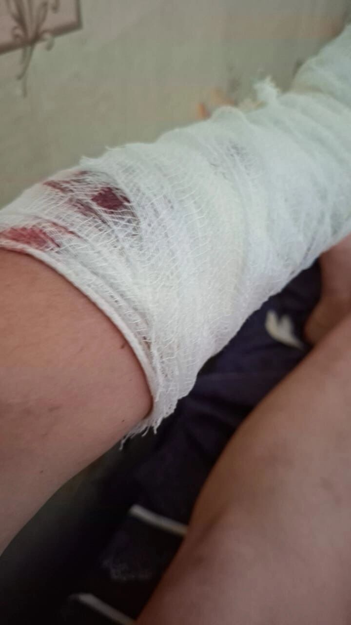  алабай вел себя очень агрессивно