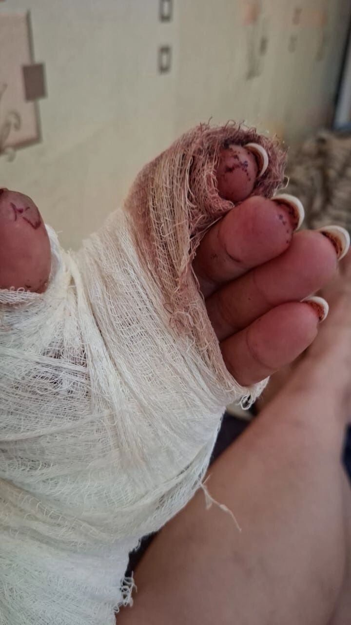 алабай вел себя очень агрессивно