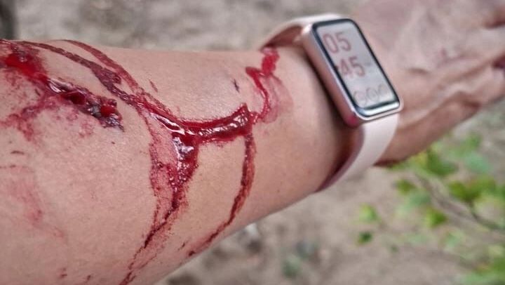 алабай вел себя очень агрессивно