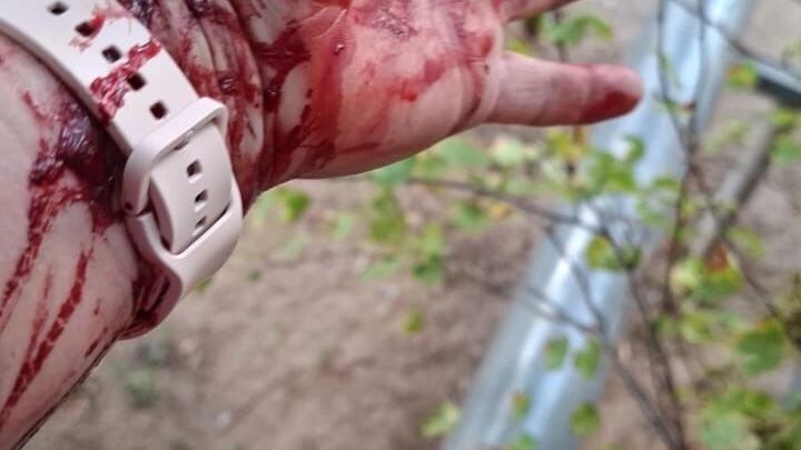 женщину алабай едва не&nbsp;лишил руки