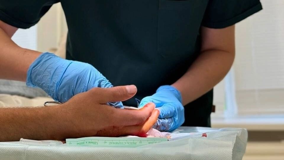 200 человек каждый день: в Ижевске растет число травмированных в быту